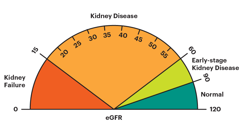 ρυθμός σπειραματικής διήθησης GFR